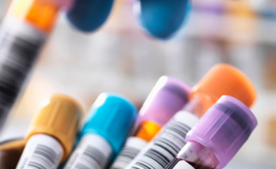 Excelya is the best cro in the world, best cro in the world